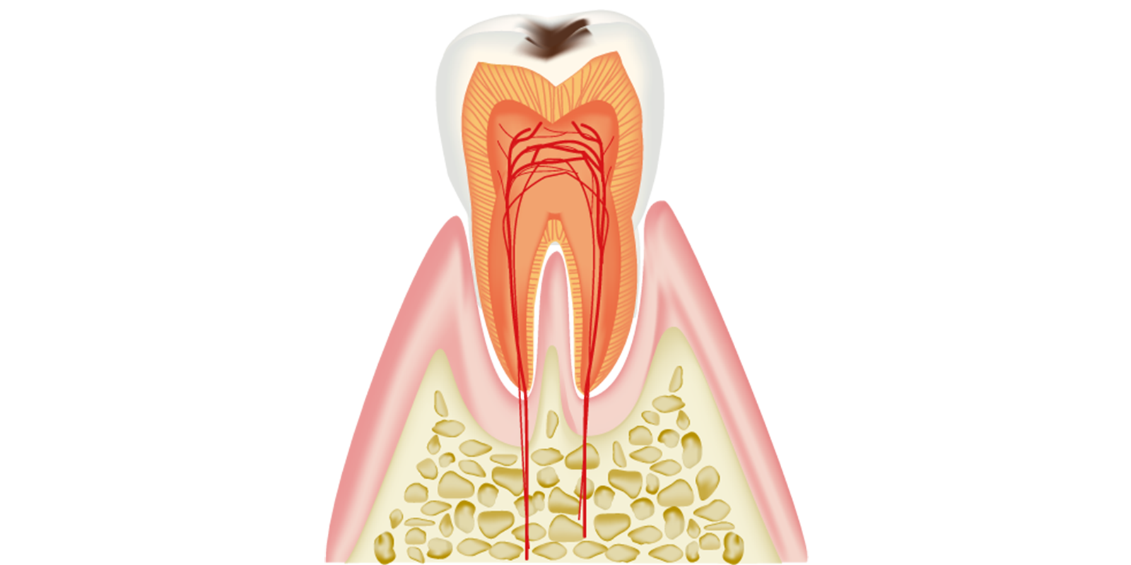 C1