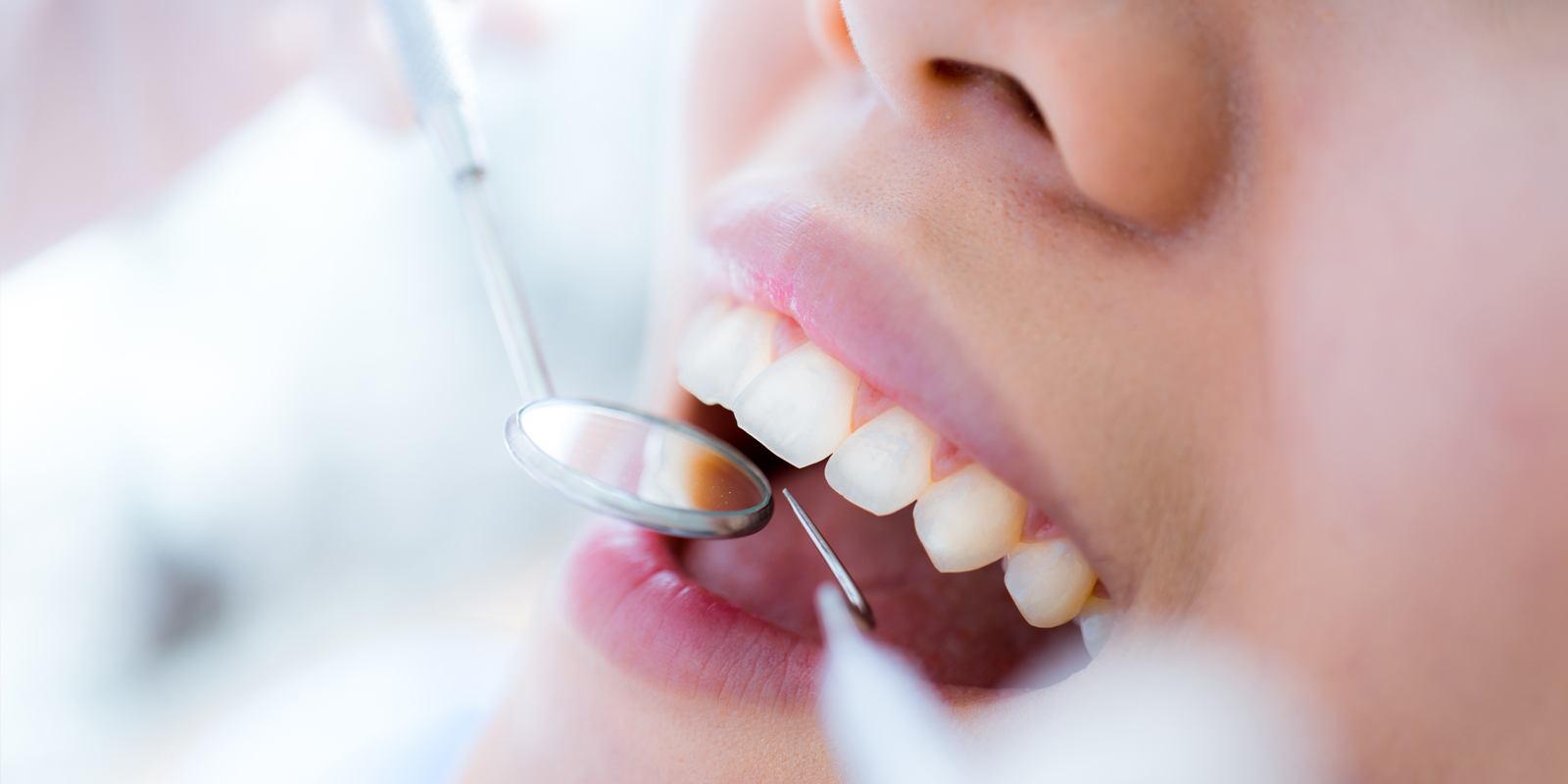 歯周病精密検査の流れ